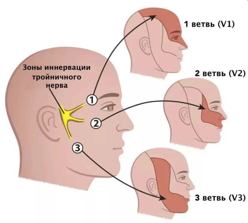 Почему немеют уши. Воспаление тройничный нерв неврология. Симптомы поражения 2 ветви тройничного нерва. Ветви тройничного нерва и зоны иннервации. При поражение 2 ветви тройничного нерва.