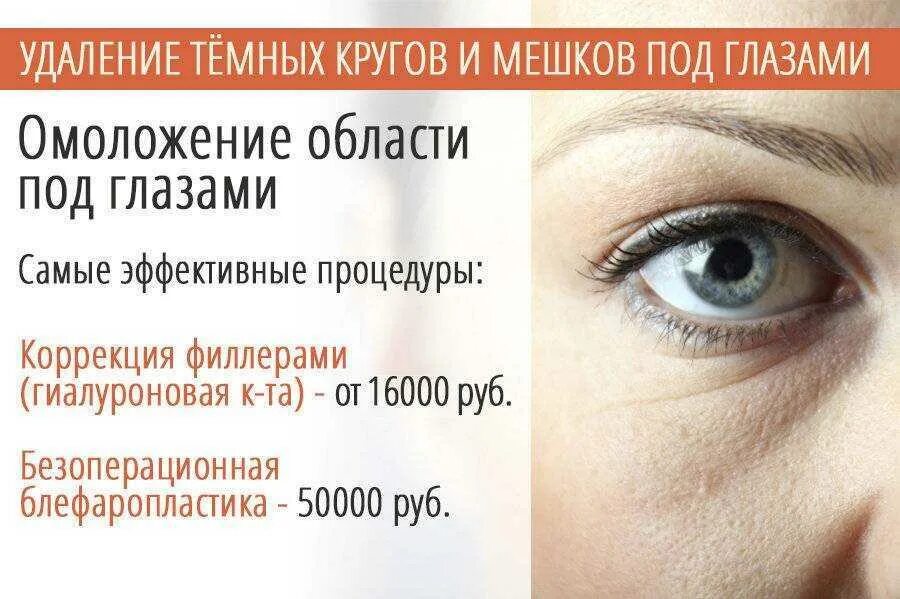 Глазами быстро и навсегда. Темные круги и мешки под глазами. мешки под глазами причины. устранение темных кругов под глазами.