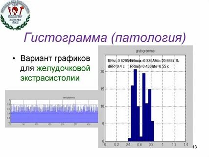 Варианты графиков