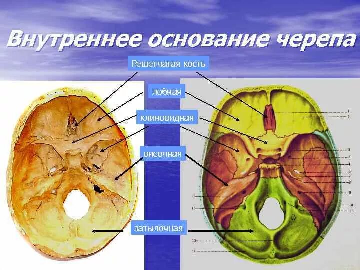 Основание черепа где. Решетчатая кость внутри. Решетчатая кость черепа анатомия. Продырявленная пластинка решетчатой кости анатомия. Клиновидная кость и решетчатая кость.