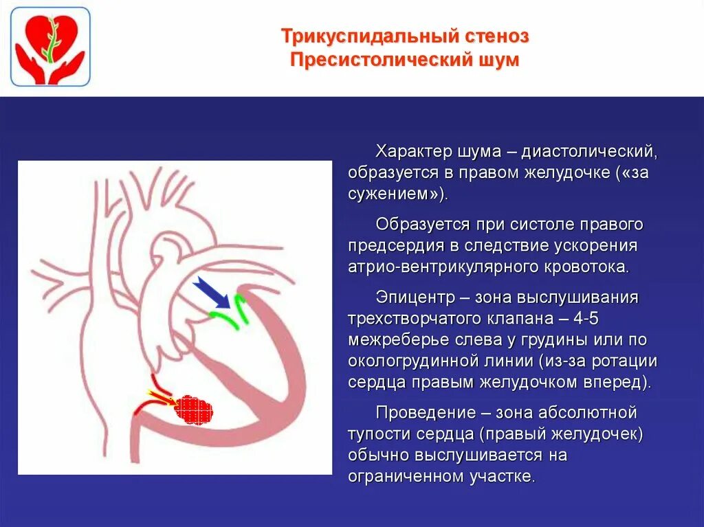 Недостаточность митрального клапана сердечный толчок. Недостаточность трехстворчатого клапана шум. Шум митральной регургитации.