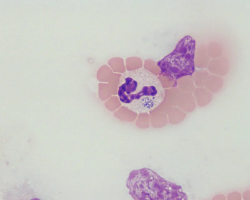 Бактерия Anaplasma phagocytophilum. Мертвые нейтрофилы фагоцитоз. Гранулоцитарный анаплазмоз.