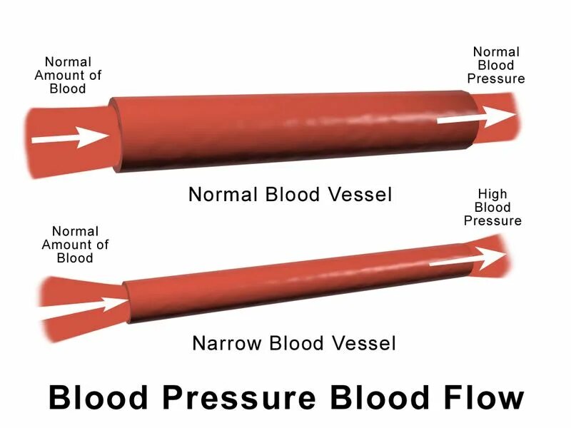 Сужение сосудов повышение давления. Сосуды при высоком давлении. Расширение сосудов давление. При повышении давления сосуды. Сужение сосудов и расширение ,давление.