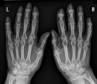 Hand 10