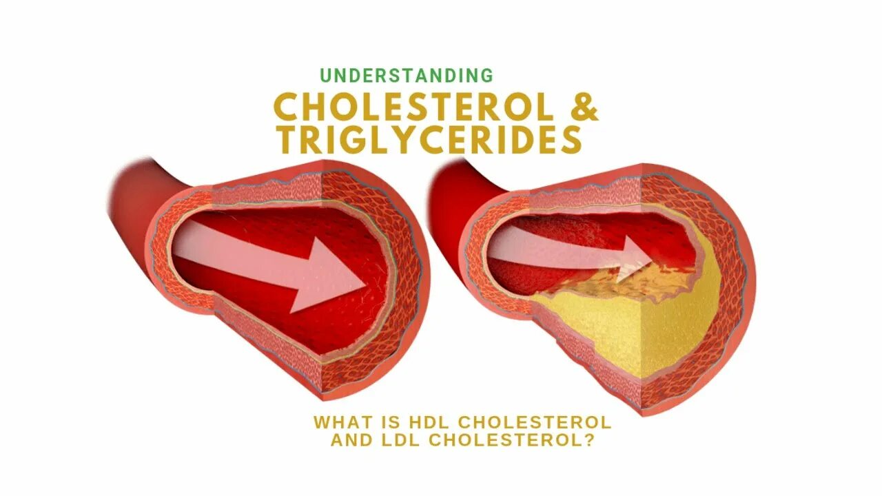 HDL cholesterol. Триглицериды картинки в сосудах. Cholesterol LDL 3.5. Триглицериды при ИБС сердца.