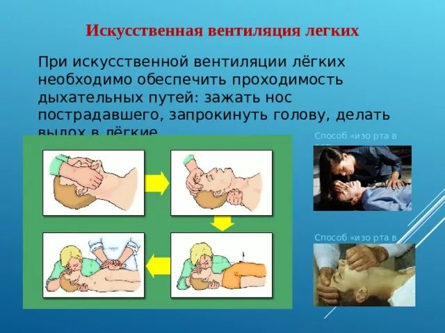 Искуственная вентиляция легких алгоритм кратко