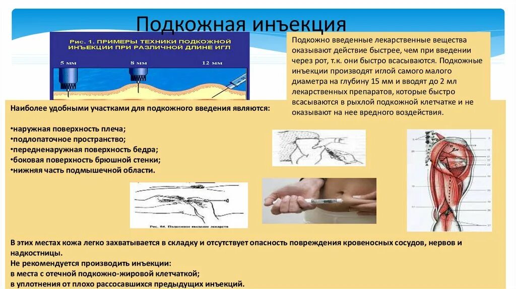 Подкожные инъекции техника выполнения. Подкожно Введение лекарственного препарата. Методика введения препарата подкожно. Алгоритм подкожной инъекции лекарственного препарата. Алгоритм выполнения инъекций подкожно.