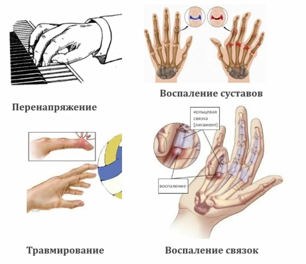 Болит основание большого пальца