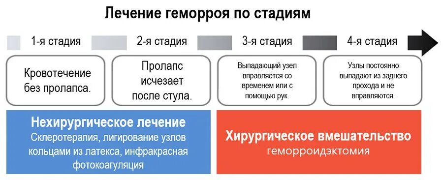 Степени и стадии геморроя.