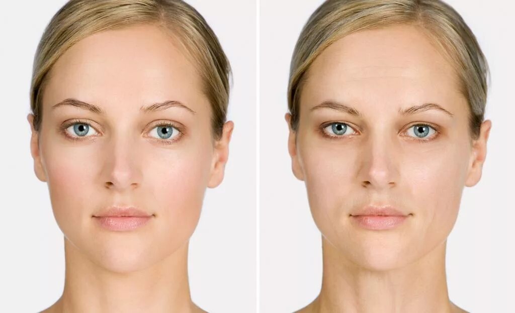 Человеческое лицо. Осунувшееся лицо. Лицо человека до и после курения.