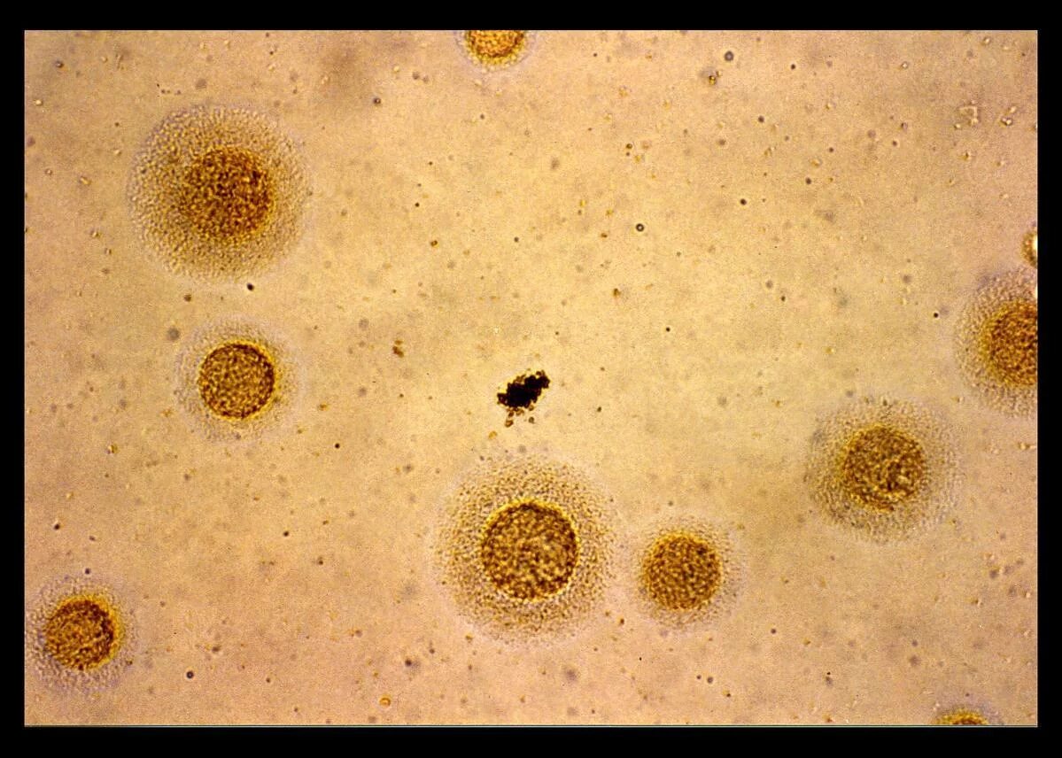 Многочисленные мелкие тельца. Микоплазма гоминис Mycoplasma. Микоплазма хоминис 1.58++. Микоплазма гоминис. M.Hominis.