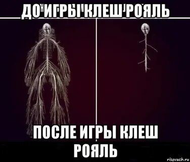 Моя последняя нервная клетка