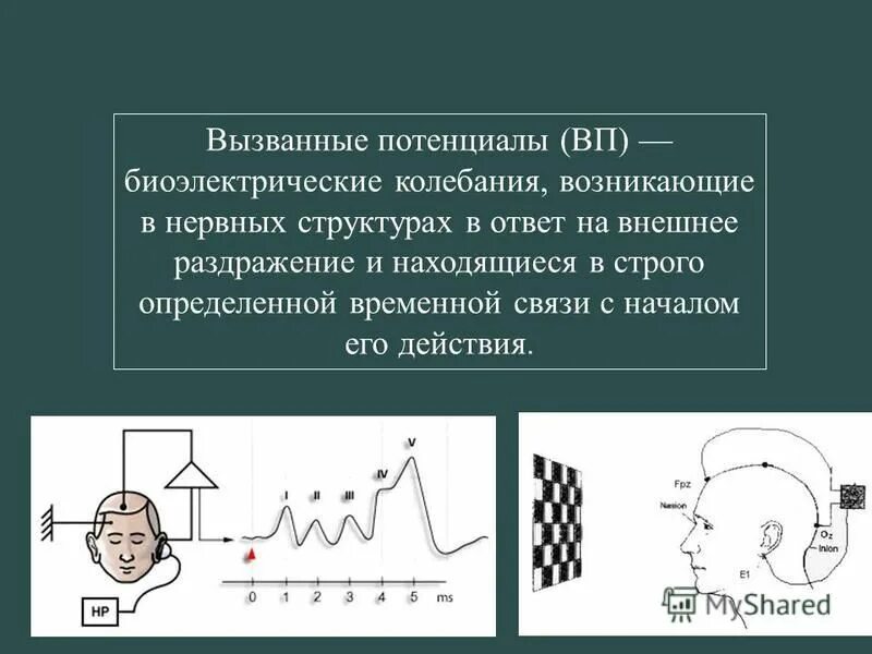 метод регистрации вызванных потенциалов головного мозга. исследования методом вызванных потенциалов. вызванные потенциалы мозга метод исследования. методика регистрации вызванных потенциалов. вертексные потенциалы на ээг.