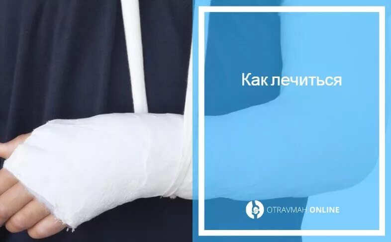 Остеосинтез лучевой кости пластиной. Трехлодыжечный перелом ноги со смещением. Перелом со смещением сколько носить гипс. Оскольчатый перелом лучевой кости. Перелом со смещением сколько носить гипс.