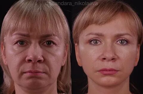 Сандара пластический хирург