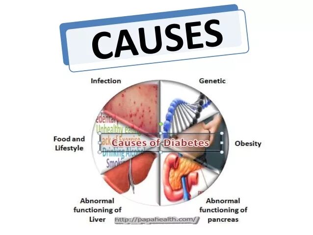 Diabetes causes. Diabetes reasons. Causes of obesity.