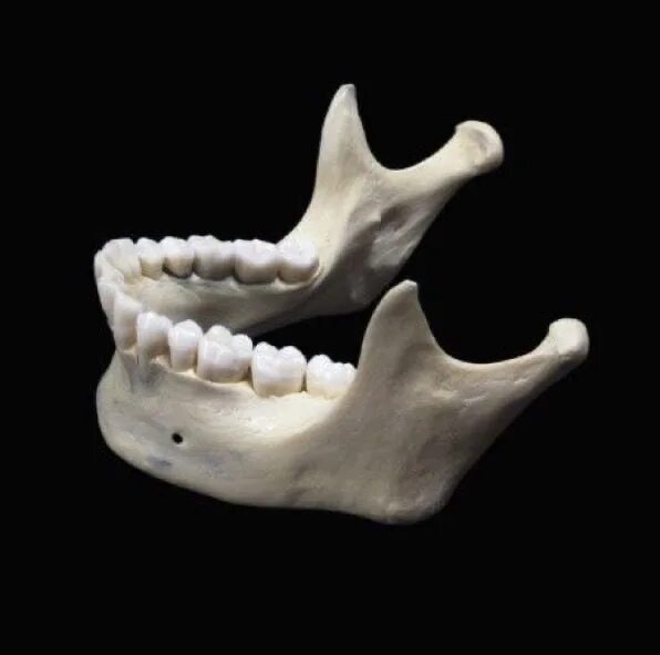 Нижняя челюсть черепа анатомия. Нижняя челюсть кость. Нижняя челюсть с другими костями черепа