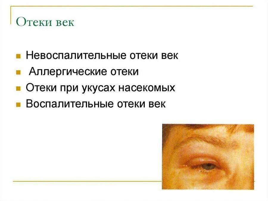 Как быстрее снять отек. Как быстрее снять отек