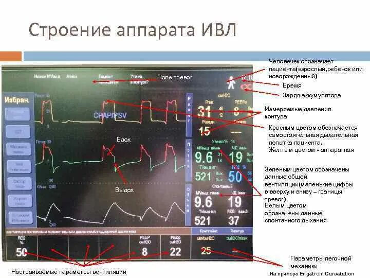 Показатели аппарата ИВЛ. Монитор ИВЛ показатели. Экран аппарата ИВЛ. Параметры аппарата ИВЛ.