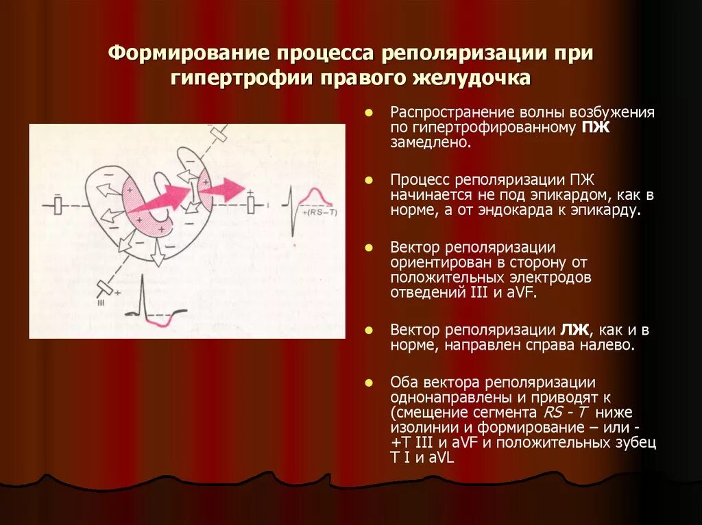 Нарушение процессов реполяризации левого желудочка. Нарушение процессов реполяризации на ЭКГ. Нарушены процессы реполяризации что это. Нарушение процессов реполяризации в нижней стенке левого желудочка. Диффузная реполяризации левого желудочка