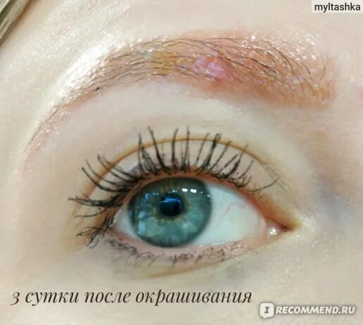 Как выглядит аллергия на бровях Лицо девушки с аллергией на косметику до и после нанесения макияжа "
