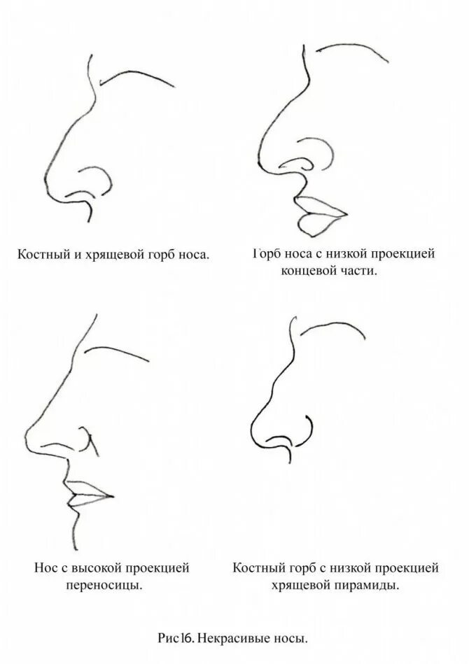 Виды носов. Виды Носов сбоку. Римский нос греческий нос отличия. Форма носа Римский. Нос вид сбоку.