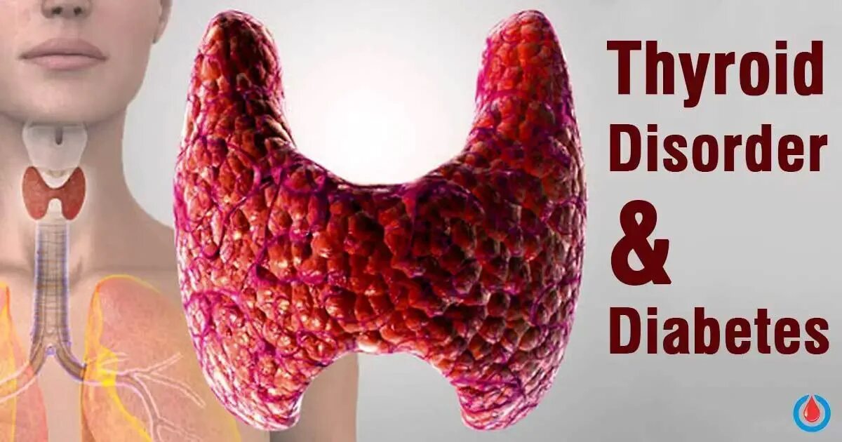 Лечение эутиреоза щитовидной железы у женщин. Диффузный токсический зоб Триада. Неоднородная щитовидная железа. Щитовидная железа Эстетика.