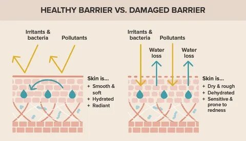 Skin barrier