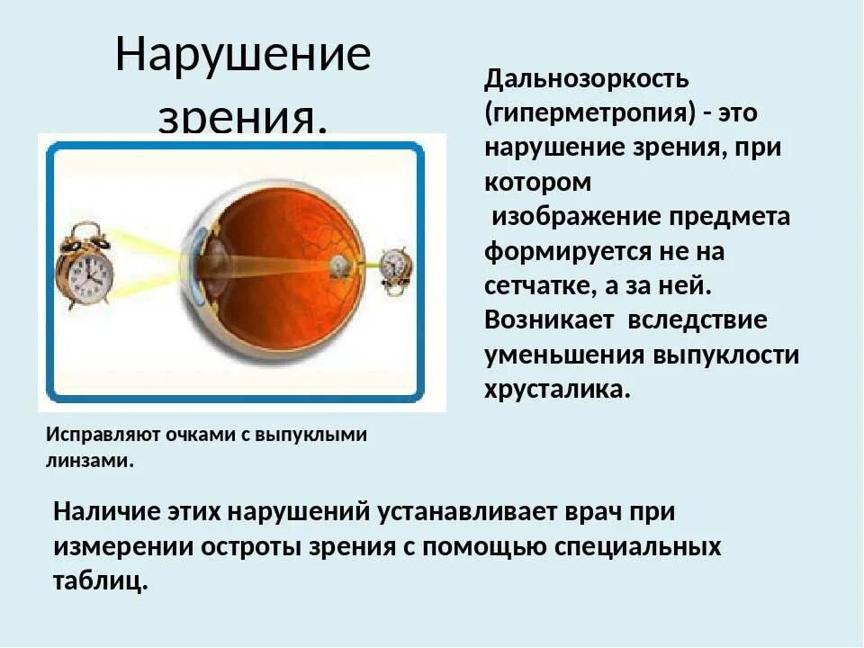 Почему у людей пожилого возраста развивается дальнозоркость. При гиперметропии могут наблюдаться следующие симптомы:. Причины возникновения дальнозоркости. Зрение дальнозоркость. Профилактика дальнозоркости.