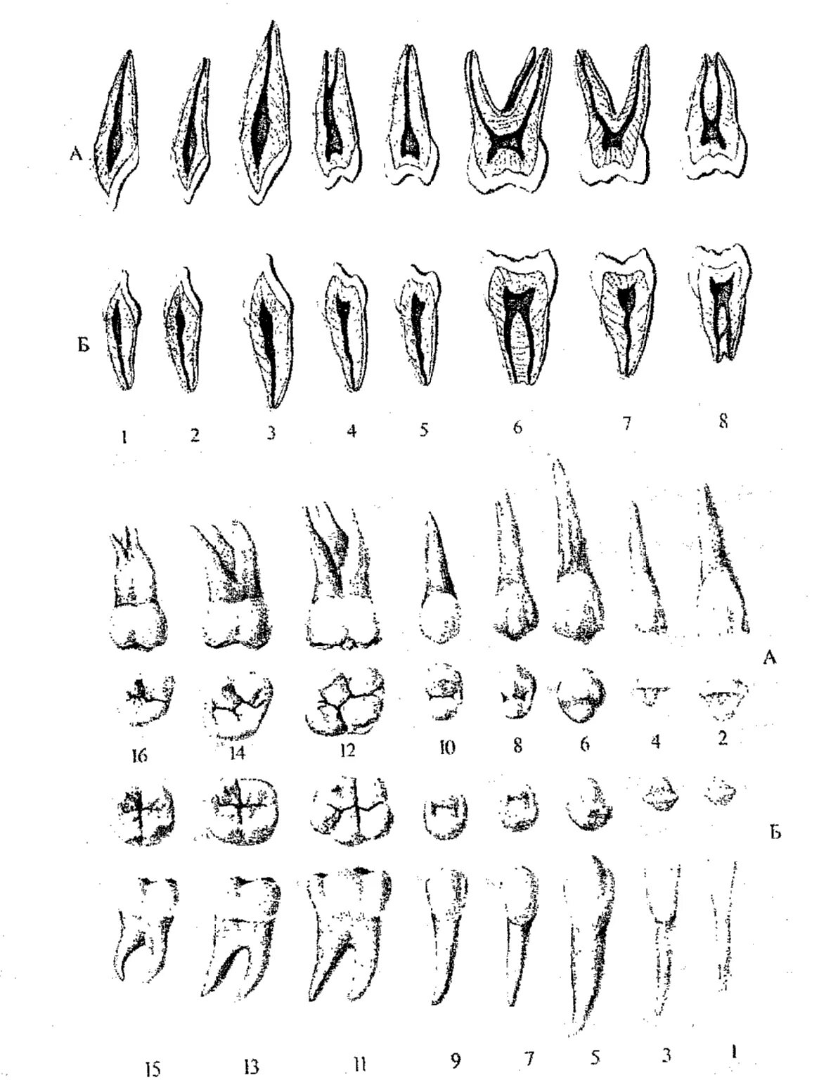 Анатомия зубов верхней челюсти. Корни 6 зуба верхней челюсти.