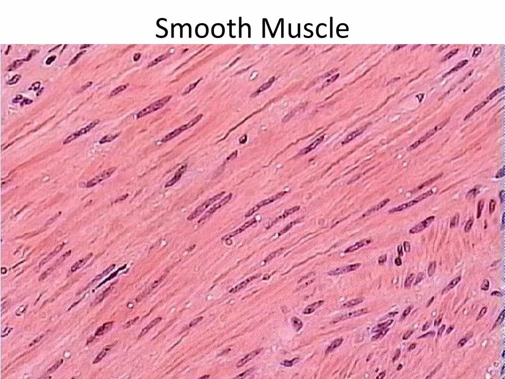Гладкие мышцы многоядерные. Гладкая мышечная ткань гистология препарат. Гладкая мышечная ткань микропрепарат. Клетки мышечной ткани гистология. Гладкомышечная ткань гистология.
