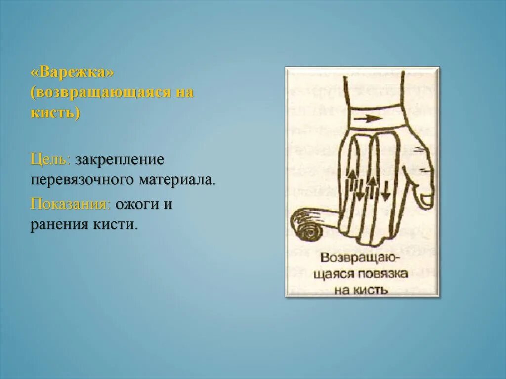 Повязка на кисть алгоритм. Десмургия возвращающаяся повязка кисть. Возвращяющаясяповязка на кисть. Возвращающаяся на кисть, «варежка». Возвращающаяся повязка на кисть показания.