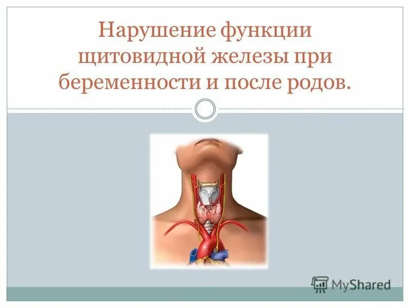 Нарушение функции щитовидной железы. Заболевание вызванное нарушением функции щитовидной железы. Признаки нарушения функции щитовидной железы. Заболевания, связанные с нарушением функций щитовидной железы. Болезни при нарушении функции щитовидной железы.