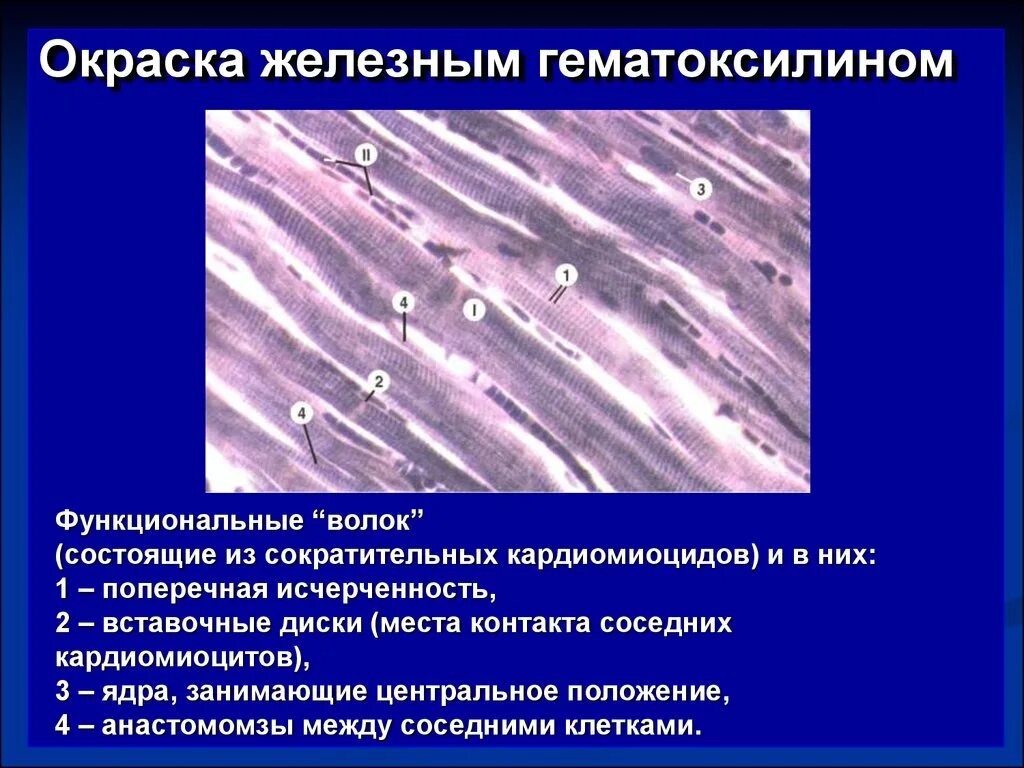 Состоит из клеток имеющих поперечную исчерченность. Окраска железным гематоксилином гистология. Сердечная мышечная ткань Железный гематоксилин. Поперечно-полосатая сердечная мышечная ткань препарат. Миокард окраска железным гематоксилином.