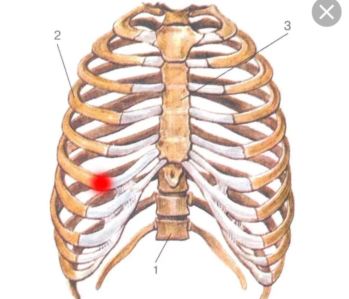 1. Грудная клетка (ребра, Грудина).. Шишка на грудной клетке спереди.