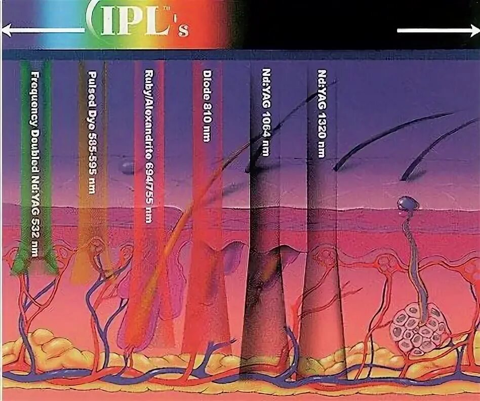 Проникнуть в глубь. Глубина проникновения лазерного излучения в ткани. Инфракрасное излучение глубина проникновения в ткани. Глубина проникновения лазерного излучения в кожу. Проникновение света на глубину.