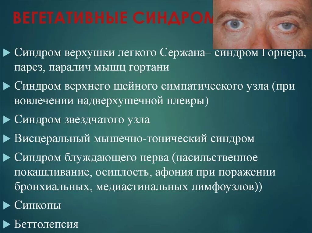 Синдром горнера. Вегетативный синдром. Симпатический синдром. Синдром верхнего шейного симпатического узла. Синдром тельце