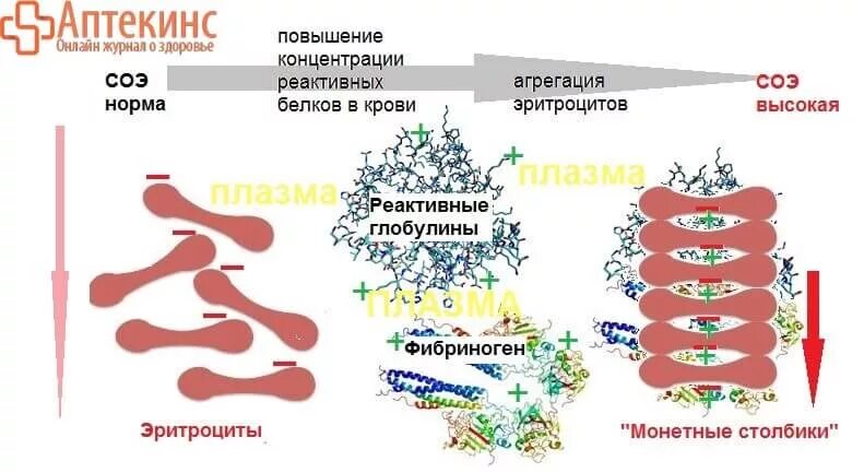 Повышенные эритроциты и соэ. Агрегация эритроцитов причины. скорость оседания эритроцитов. механизм увеличения соэ. механизм слипания эритроцитов.