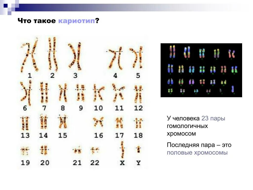 Кариотипирование супругов цена. Кариотип Результаты анализа расшифровка. Результат анализа кариотипа норма. Кариотип заключение генетика. Анализ на кариотип норма.