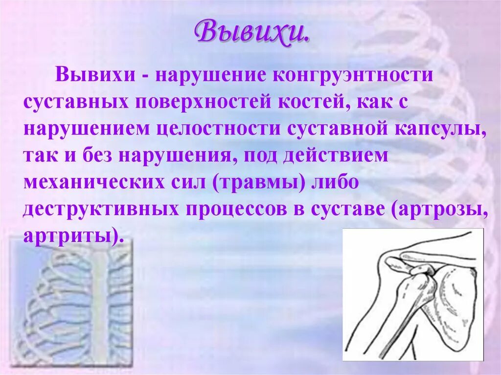 Презентация на тему вывих. Вывих костей презентация. Презентация на тему вывихи суставов.