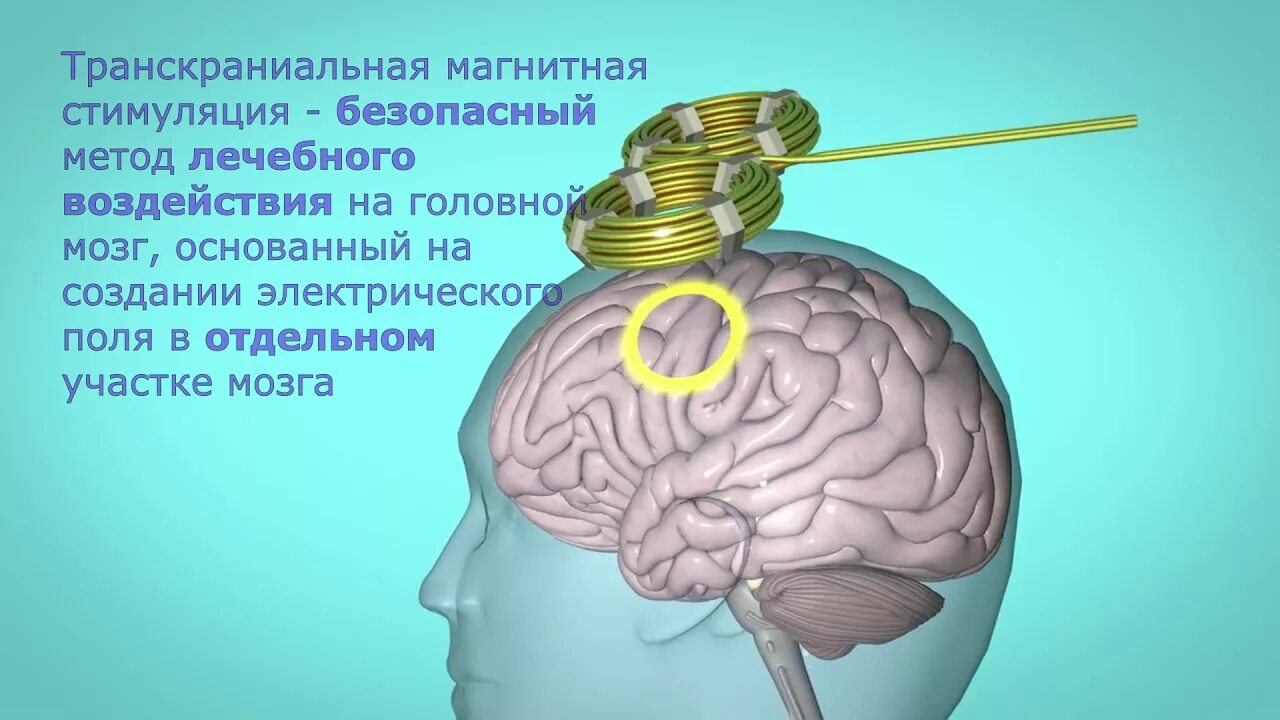 Мозг магнитное поле. Магнитная стимуляция ТМС. Транскраниальная магнитная стимуляция головного мозга аппарат. ТМС стимуляция мозга. Транскраниальная магнитная стимуляция (ТМС)– аппарат.