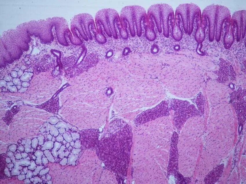 Тканевые железы. Тканевые железы. Железистый эпителий картинка ткани. Тканевые железы. Классификация экзокринных желез гистология.