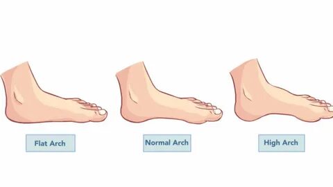Flat footed