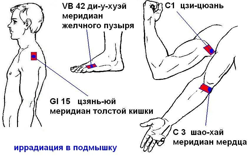 Болит левое плече у мужчины. Болит рука сбоку плеча. Отдает в левое предплечье.