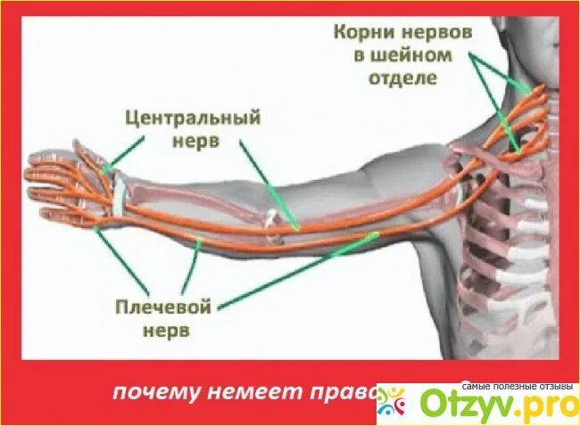 Почему немеет левая рука что делать. Болит и немеет правая рука. Немеют руки.