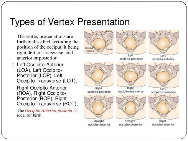 Vertex normal. Vertex position. Vertex position. Vertex form of parabola. Vertex usa.