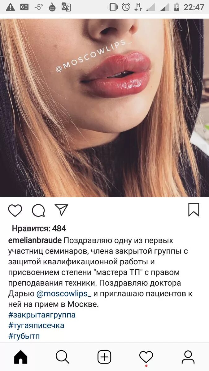 Отзыв про косметолога. Емельян Брауде губы ТП. Емельян Брауде косметолог. Техника Емельяна Брауде губы.