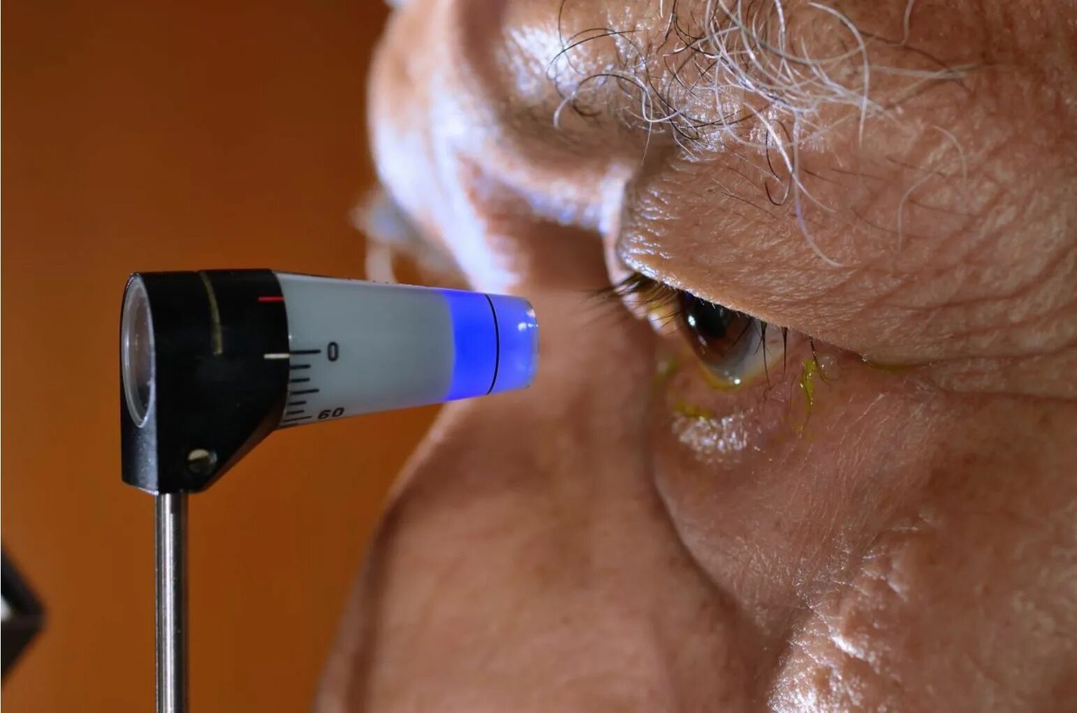 Внутриглазное давление глаукома. Тонометрия. Измерение глазного давления. Зрение после 60 лет