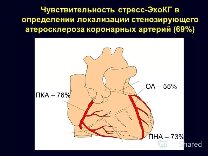 Атеросклеротические изменения коронарных артерий. Стенозирующий атеросклероз коронарных артерий. Коронарная артерия гистология. Стенозирующий атеросклероз венечной артерии сердца. Атеросклероз венечной артерии гистология.