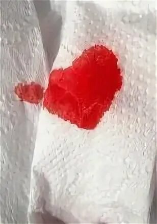 После стула крови на туалетной бумаге